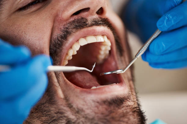 Tooth Infection Emergency Dentist in OH