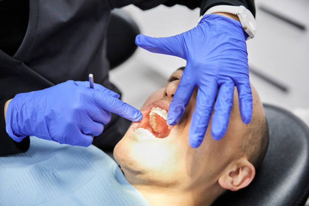 Best Broken Tooth Emergency  in Holland, OH