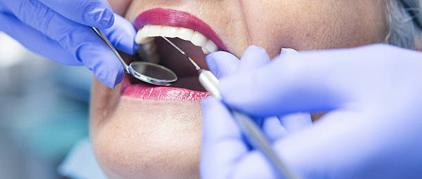 Best Chipped Tooth Repair Near Me  in Holland, OH